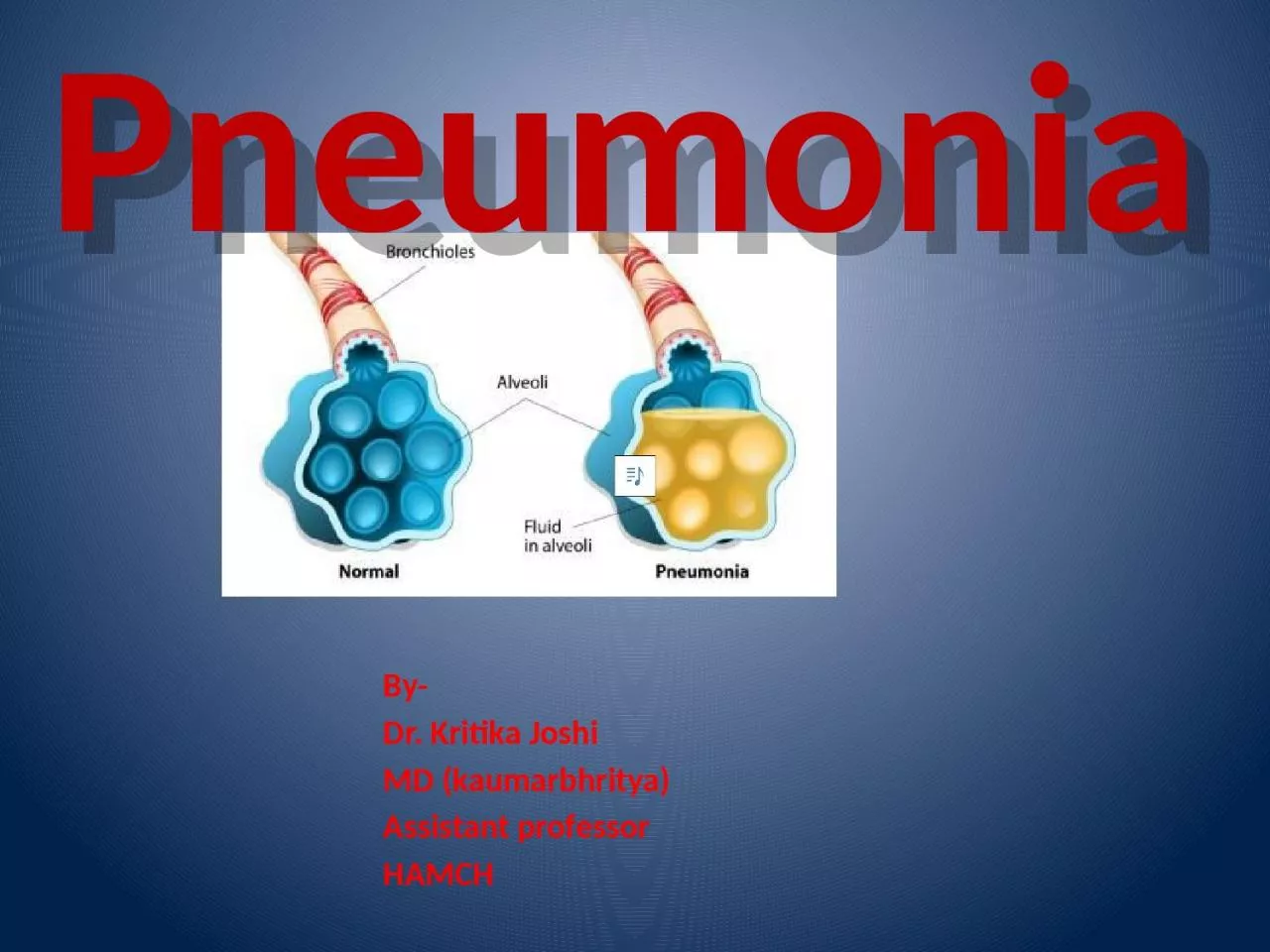 PPT-Pneumonia By- Dr. Kritika