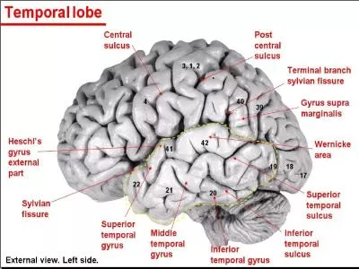 White matter: It is inside the cerebrum and has the following types of nerve fibers or called the