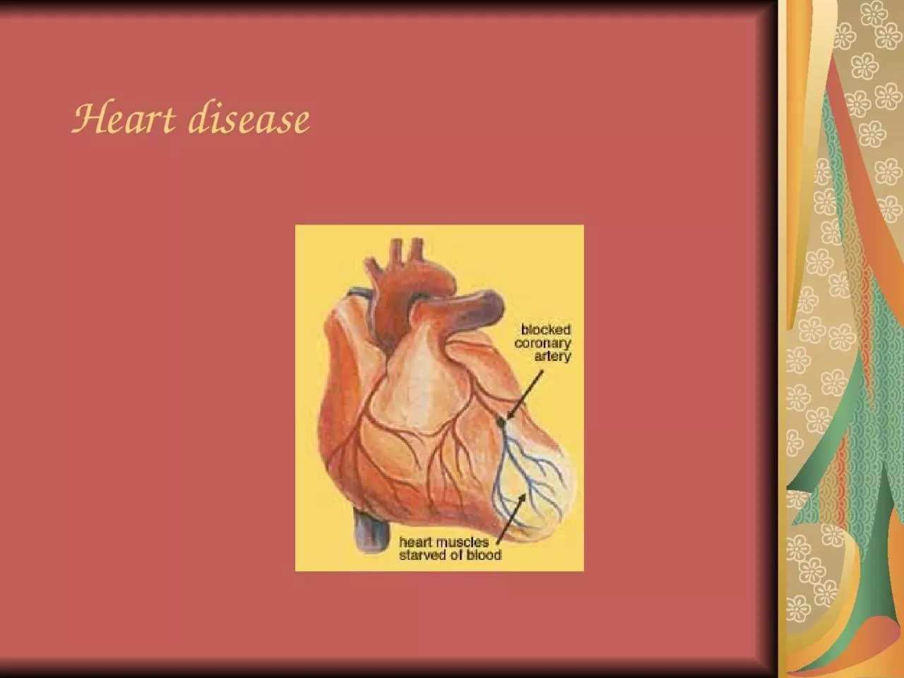 Heart disease Some facts: