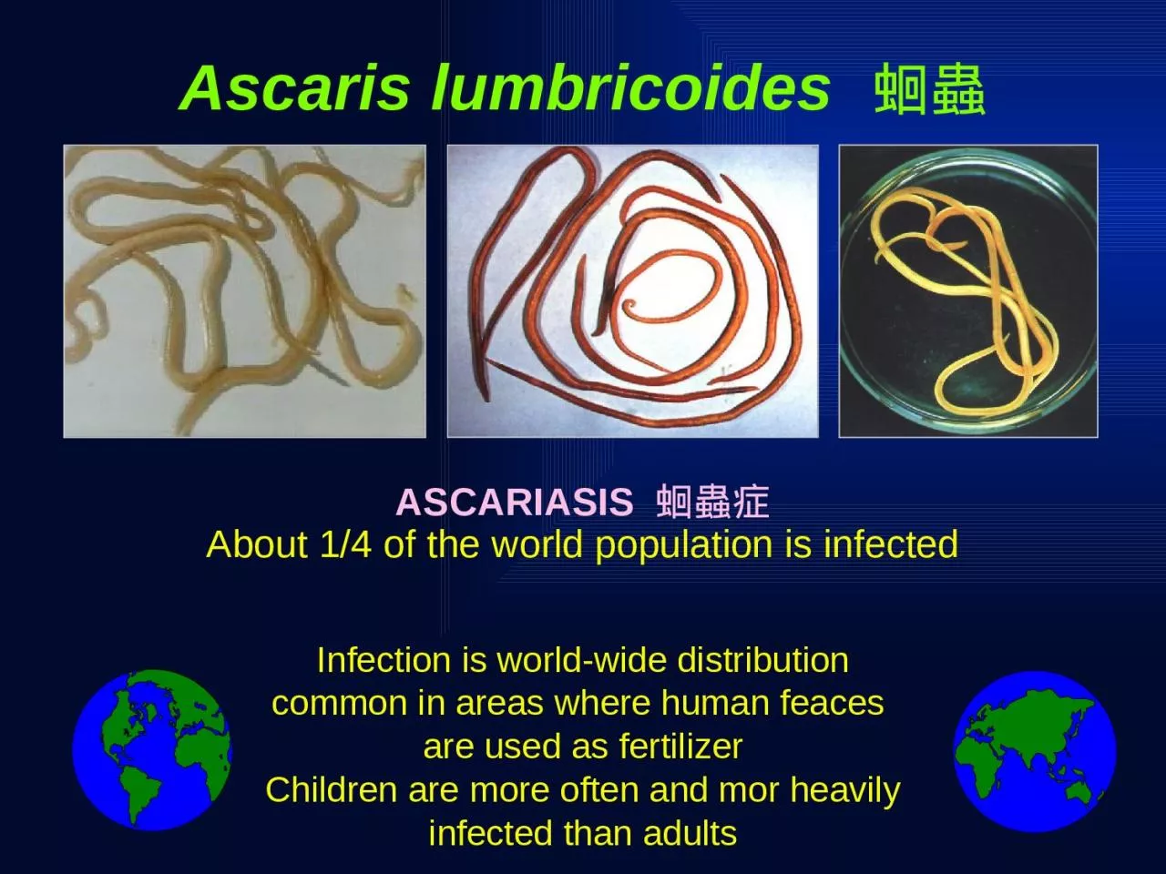 PPT-ASCARIASIS 蛔蟲症 About 1/4 of the world population is infected