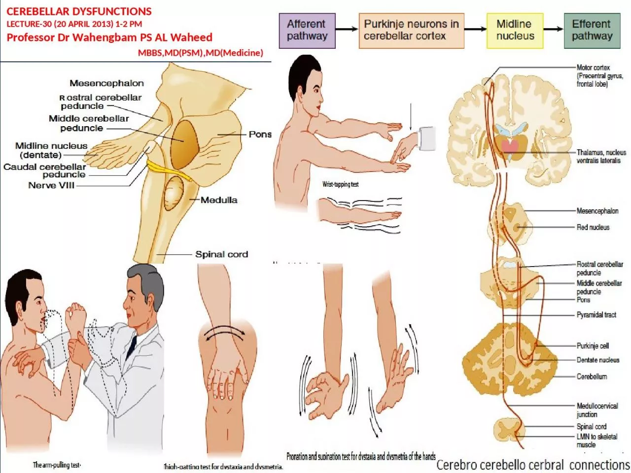 PPT-CEREBELLAR DYSFUNCTIONS