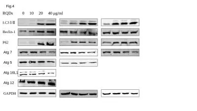 Beclin-1    LC3 Ⅰ/Ⅱ
