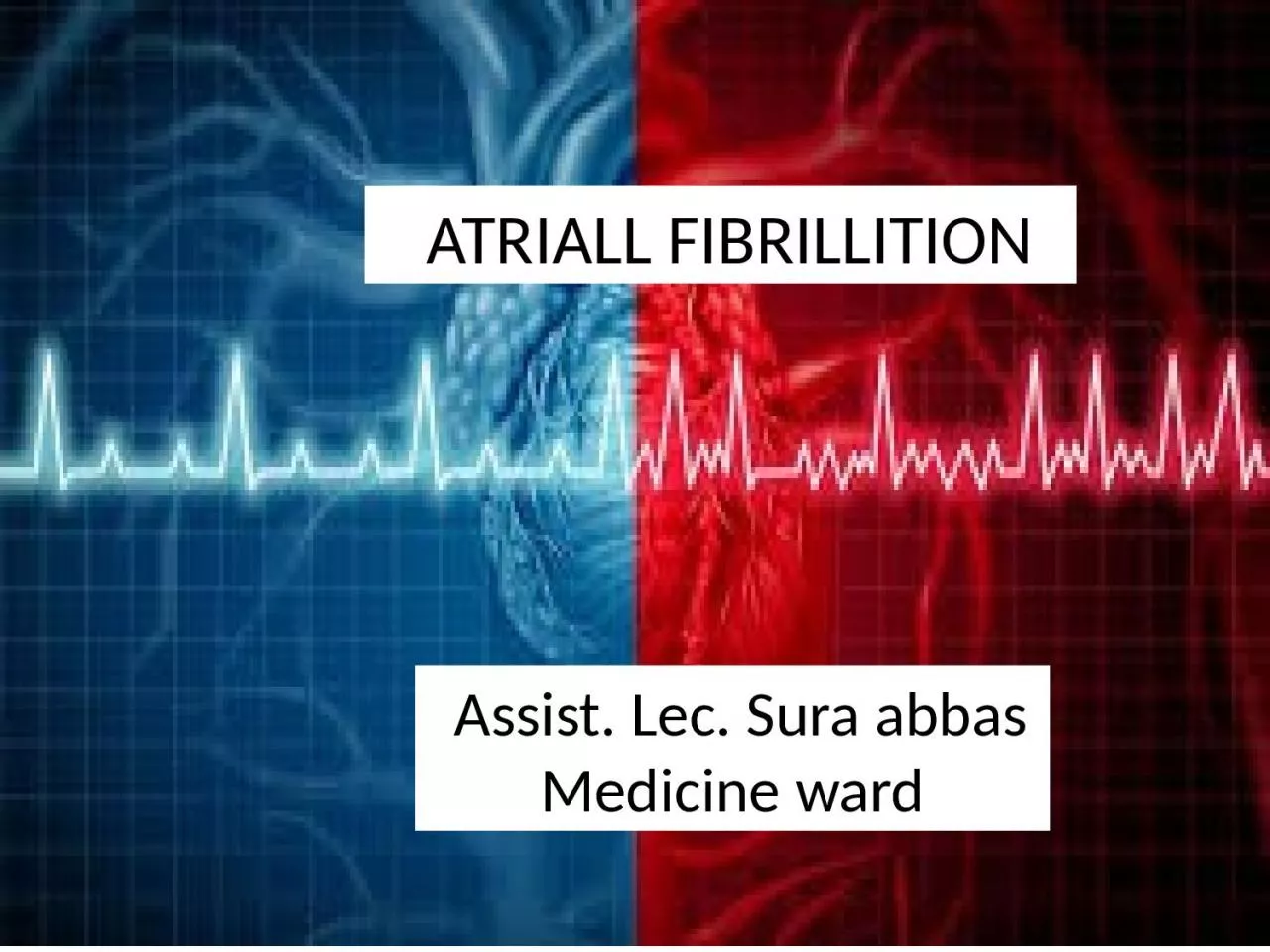 PPT-ATRIALL FIBRILLITION Assist.