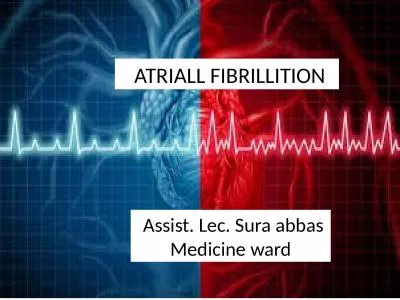 ATRIALL FIBRILLITION  Assist.