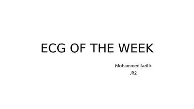 ECG OF THE WEEK Mohammed