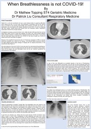 When Breathlessness is not COVID-19!