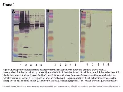 Figure 4 Figure 4.&nbsp;Western blot and cross-adsorption results in a patient with