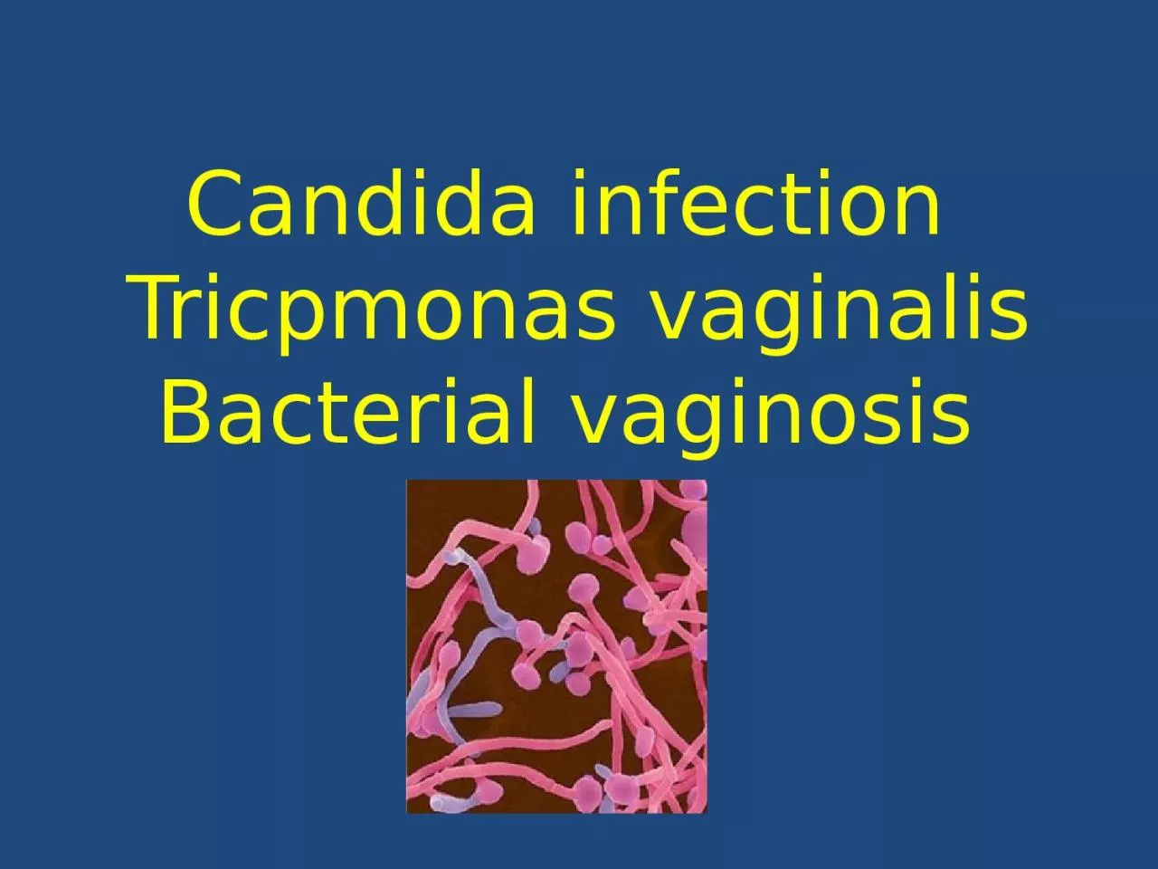 Candida infection  T ricpmonas