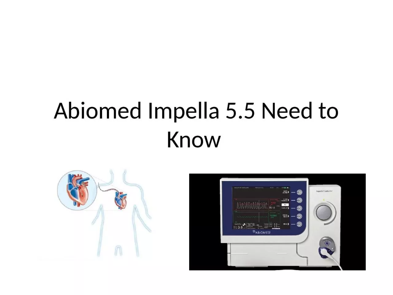 PPT-Abiomed Impella 5.5 Need to Know