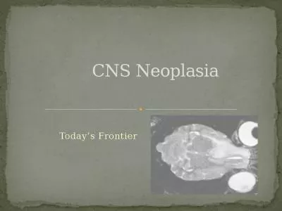 CNS Neoplasia Today’s Frontier