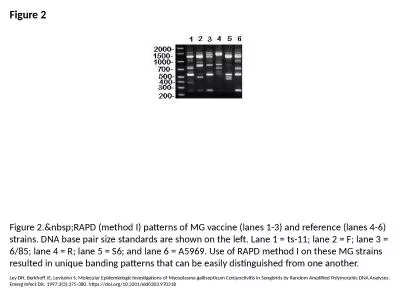 Figure 2 Figure 2.&nbsp;RAPD (method I) patterns of MG vaccine (lanes 1-3) and reference