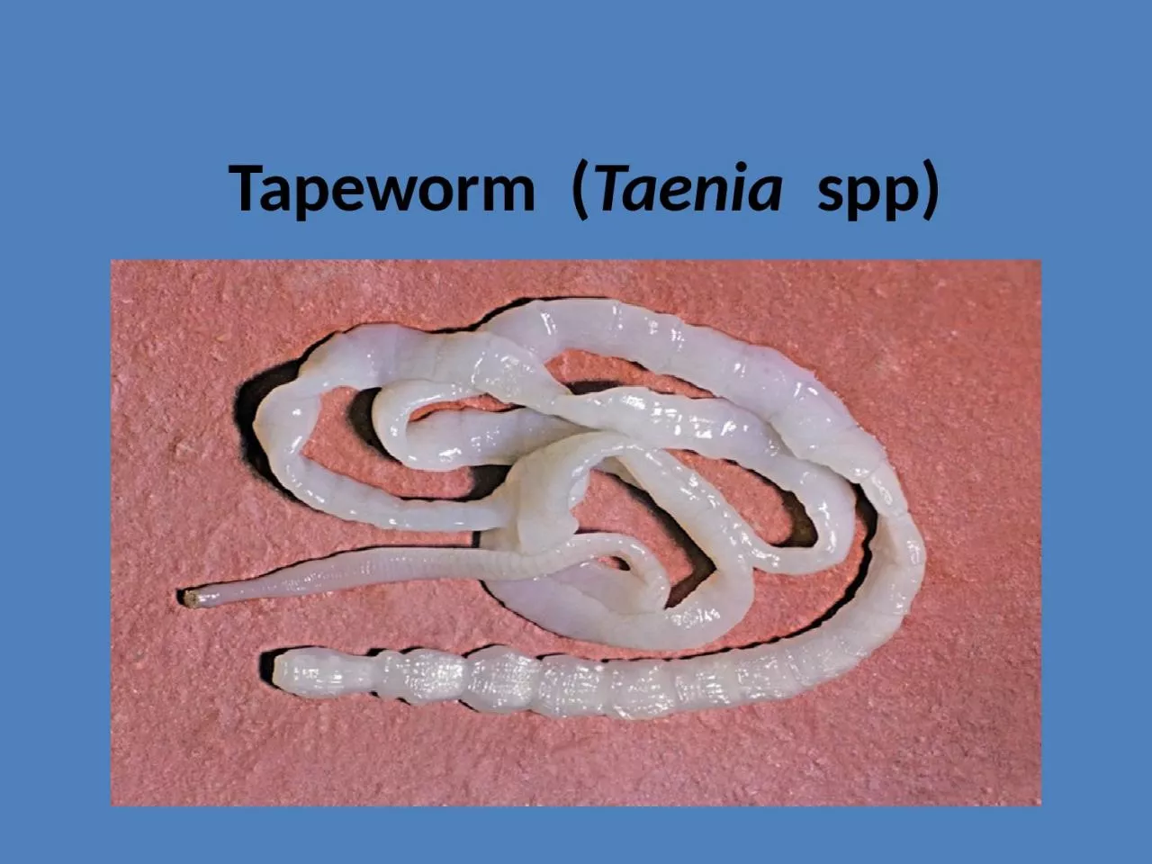 PPT-Tapeworm ( Taenia spp