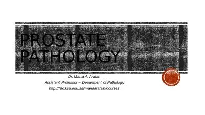 Prostate pathology Dr. Maria A. Arafah