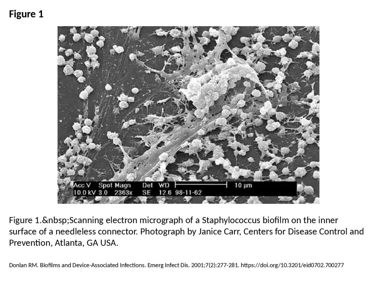 PPT-Figure 1 Figure 1.&nbsp;Scanning electron micrograph of a Staphylococcus biofilm on