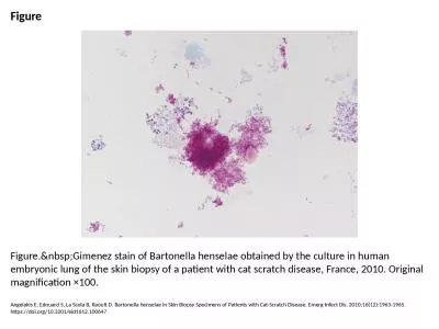 Figure Figure.&nbsp;Gimenez stain of Bartonella henselae obtained by the culture in