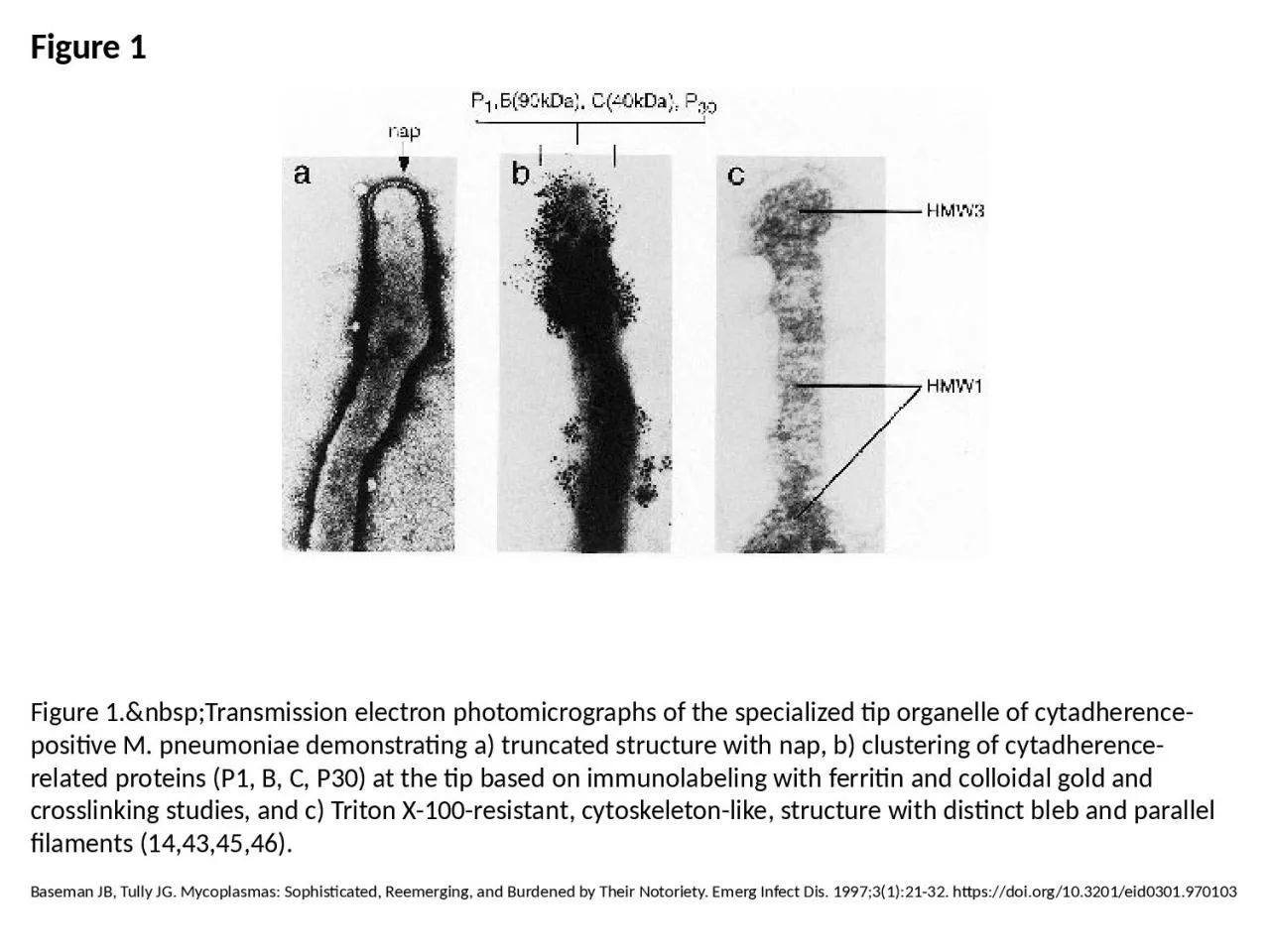 PPT-Figure 1 Figure 1.&nbsp;Transmission electron photomicrographs of the specialized