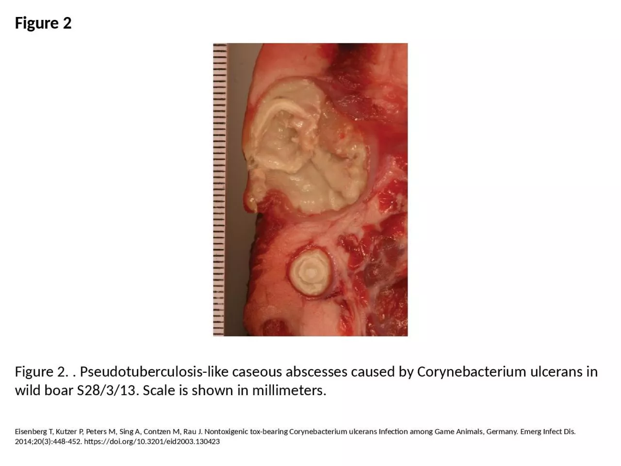 PPT-Figure 2 Figure 2. . Pseudotuberculosis-like caseous abscesses caused by Corynebacterium