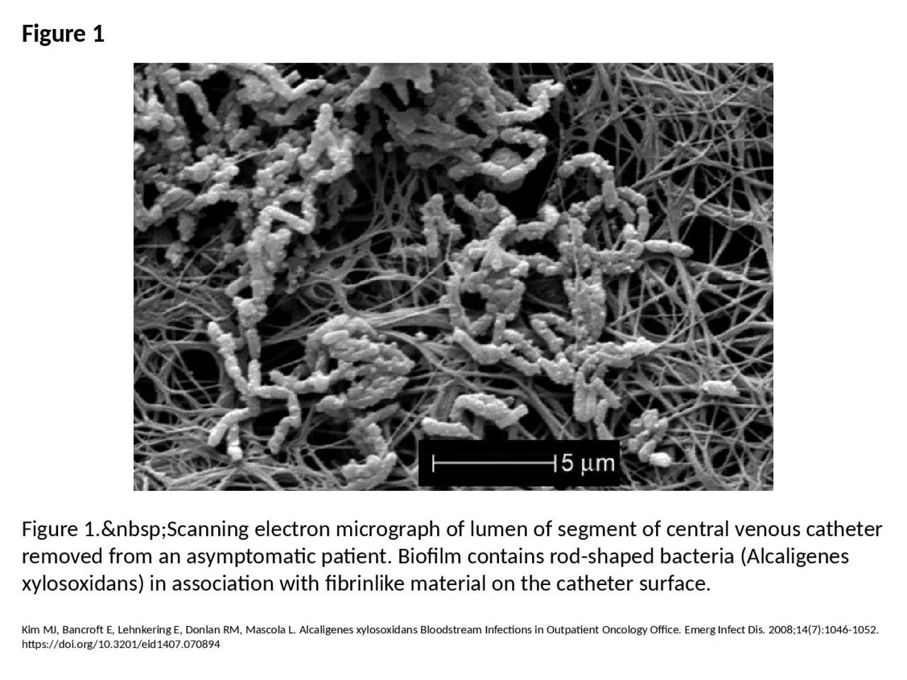 Figure 1 Figure 1.&nbsp;Scanning electron micrograph of lumen of segment of central