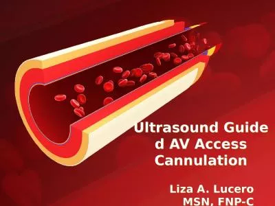 Ultrasound   Guided  AV Access