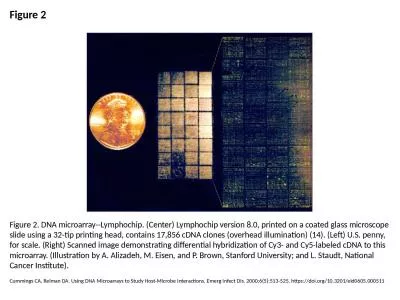 Figure 2 Figure 2. DNA microarray--Lymphochip. (Center) Lymphochip version 8.0, printed on a coated