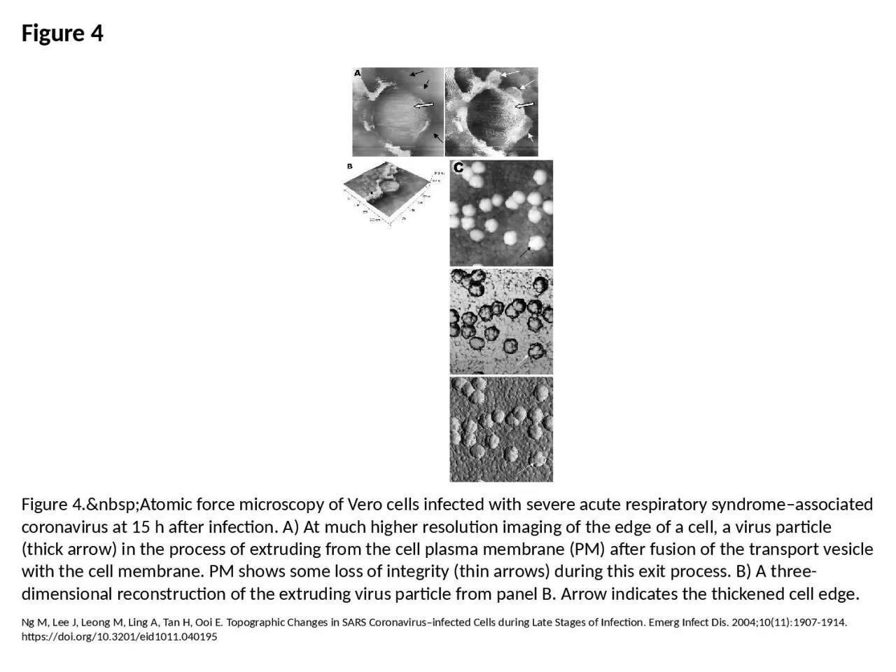 PPT-Figure 4 Figure 4.&nbsp;Atomic force microscopy of Vero cells infected with severe