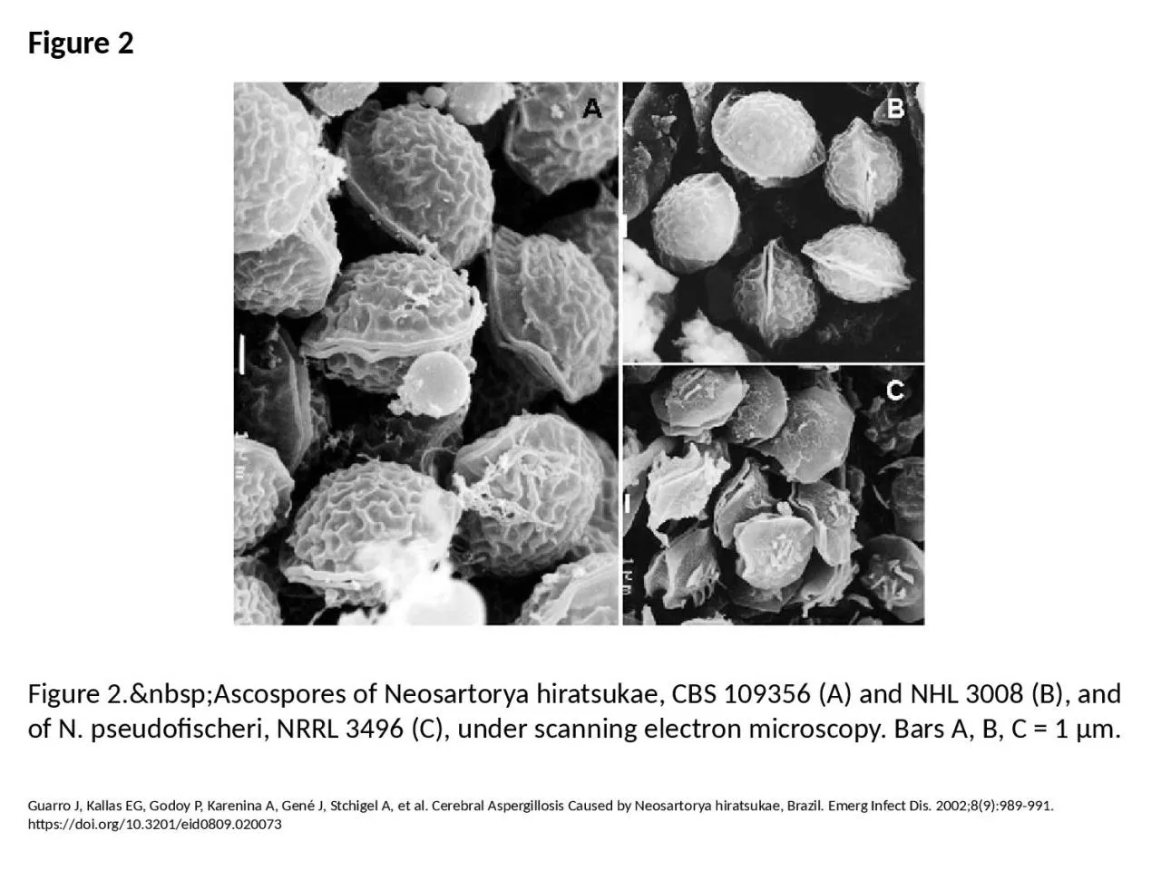 Figure 2 Figure 2.&nbsp;Ascospores of Neosartorya hiratsukae, CBS 109356 (A) and NHL