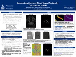 Automating Cerebral Blood Vessel Tortuosity Calculations in MRI