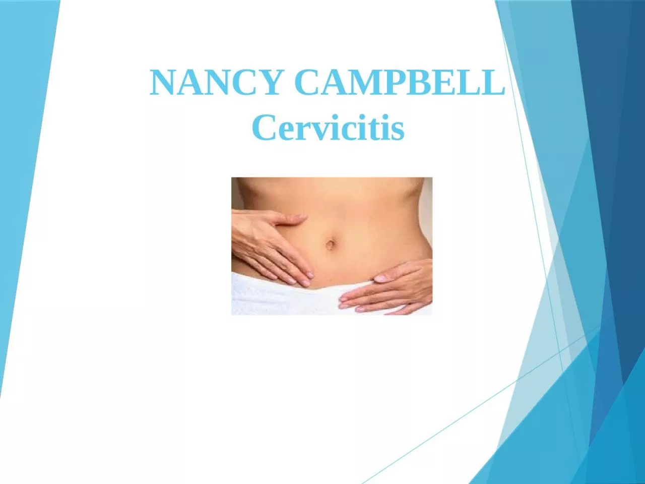 NANCY CAMPBELL Cervicitis