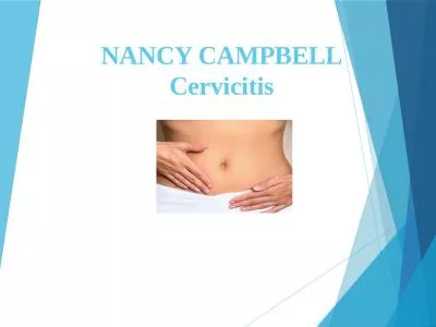 NANCY CAMPBELL Cervicitis