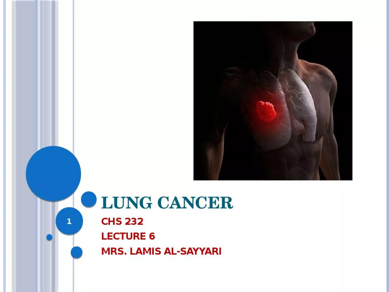 Lung Cancer CHS 232  Lecture 6