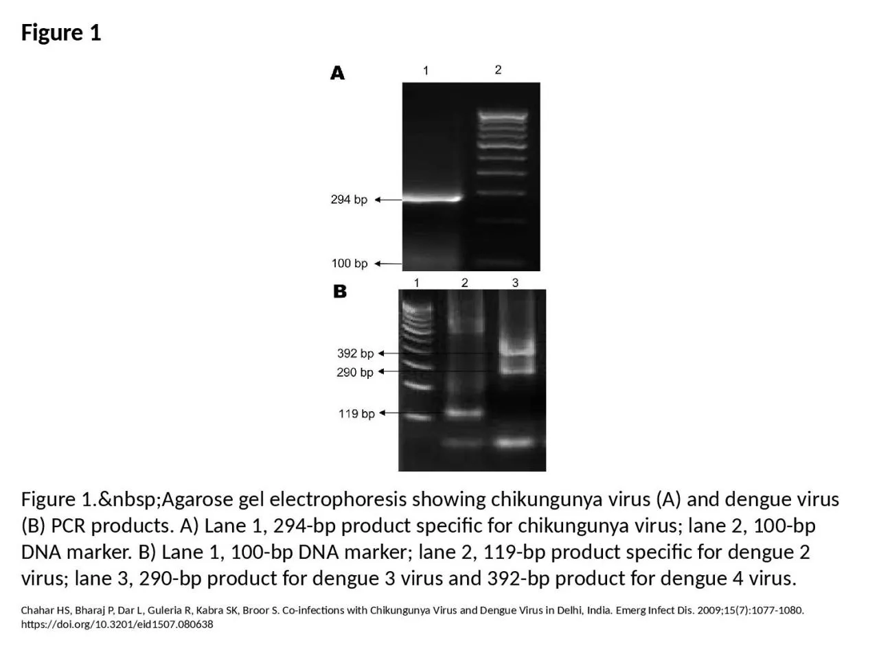 PPT-Figure 1 Figure 1.&nbsp;Agarose gel electrophoresis showing chikungunya virus (A)