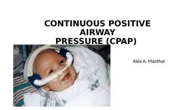 CONTINUOUS POSITIVE AIRWAY