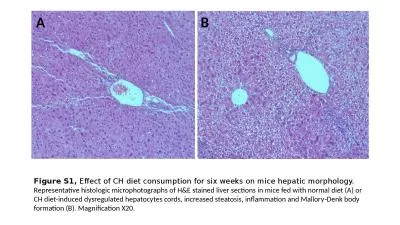 Figure S1,  Effect  of CH diet consumption for six weeks