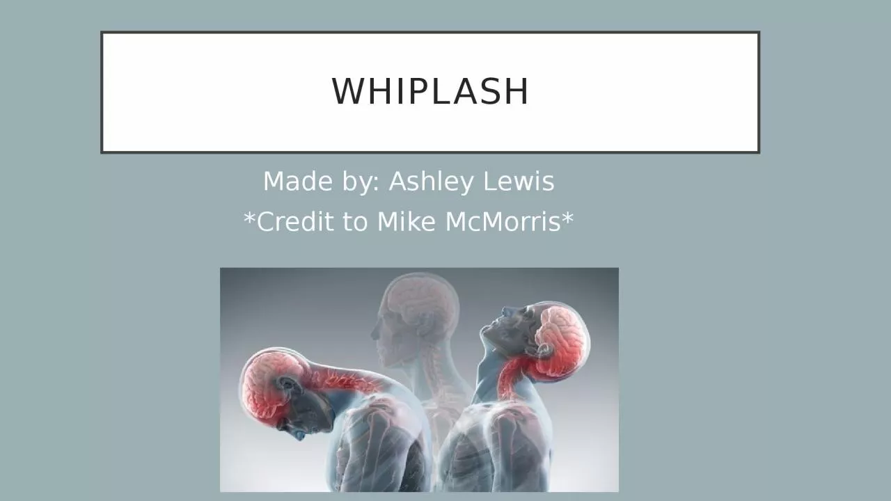 PPT-Whiplash Made by: Ashley Lewis