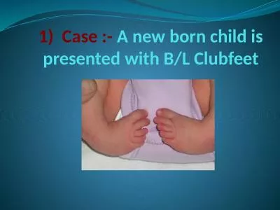 1)  Case :-  A new born child is presented with B/L Clubfeet