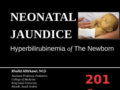 NEONATAL JAUNDICE Hyperbilirubinemia