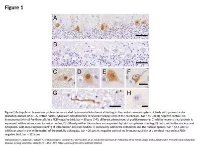Figure 1 Figure 1.&nbsp;Avian bornavirus protein demonstrated by immunohistochemical testing in