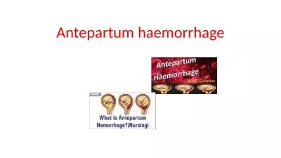 Antepartum  haemorrhage ETIOLOGY