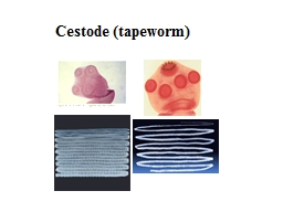 Cestode (tapeworm)     