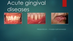 Acute gingival diseases Presented by –