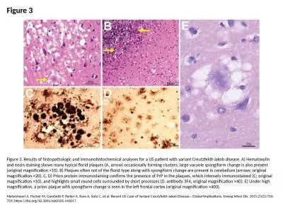 Figure 3 Figure 3. Results of histopathologic and immunohistochemical analyses for a US
