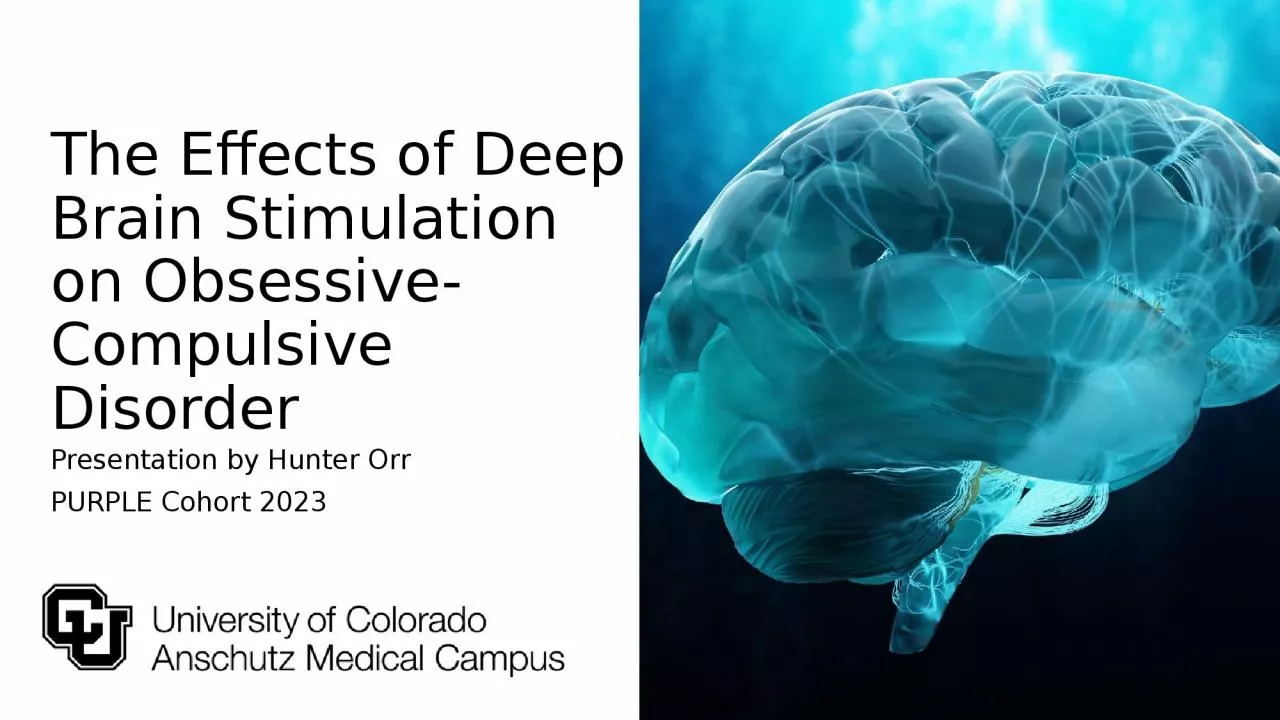 The Effects of Deep Brain Stimulation on Obsessive-Compulsive Disorder