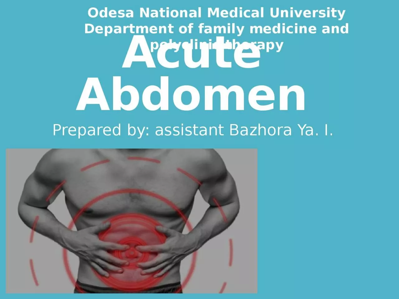 Acute Abdomen Prepared by: assistant