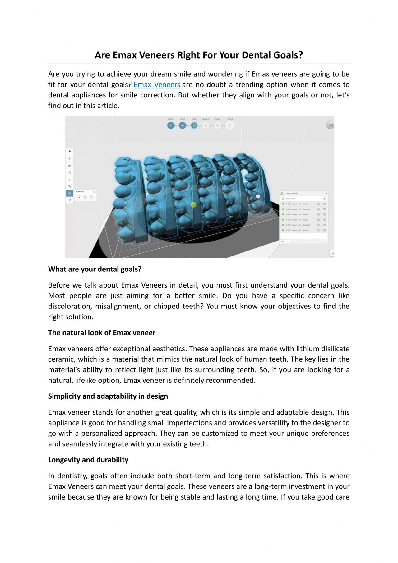 Are Emax Veneers Right For Your Dental Goals?