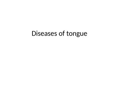 Diseases of tongue Macroglossia