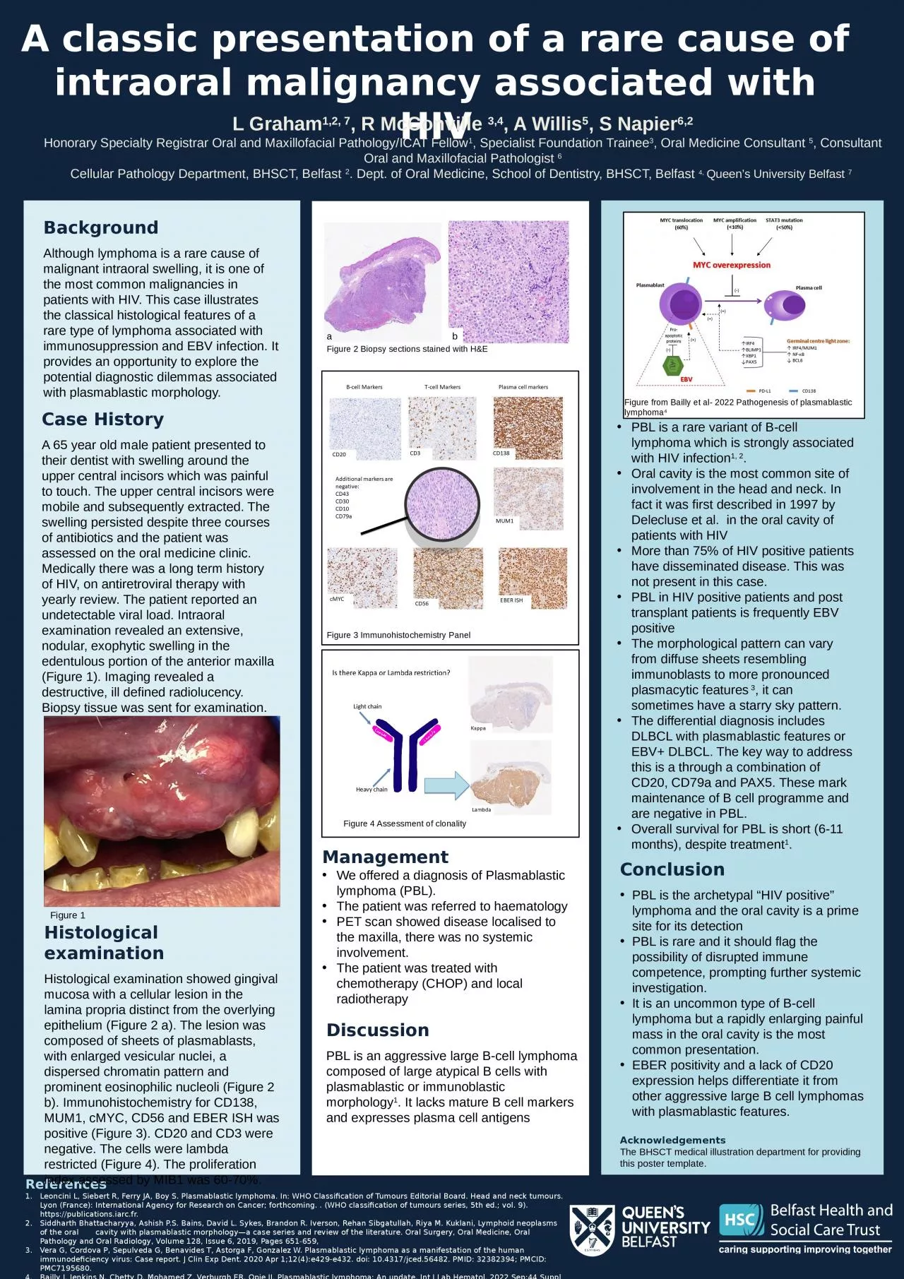 A classic presentation of a rare cause of intraoral malignancy associated with HIV