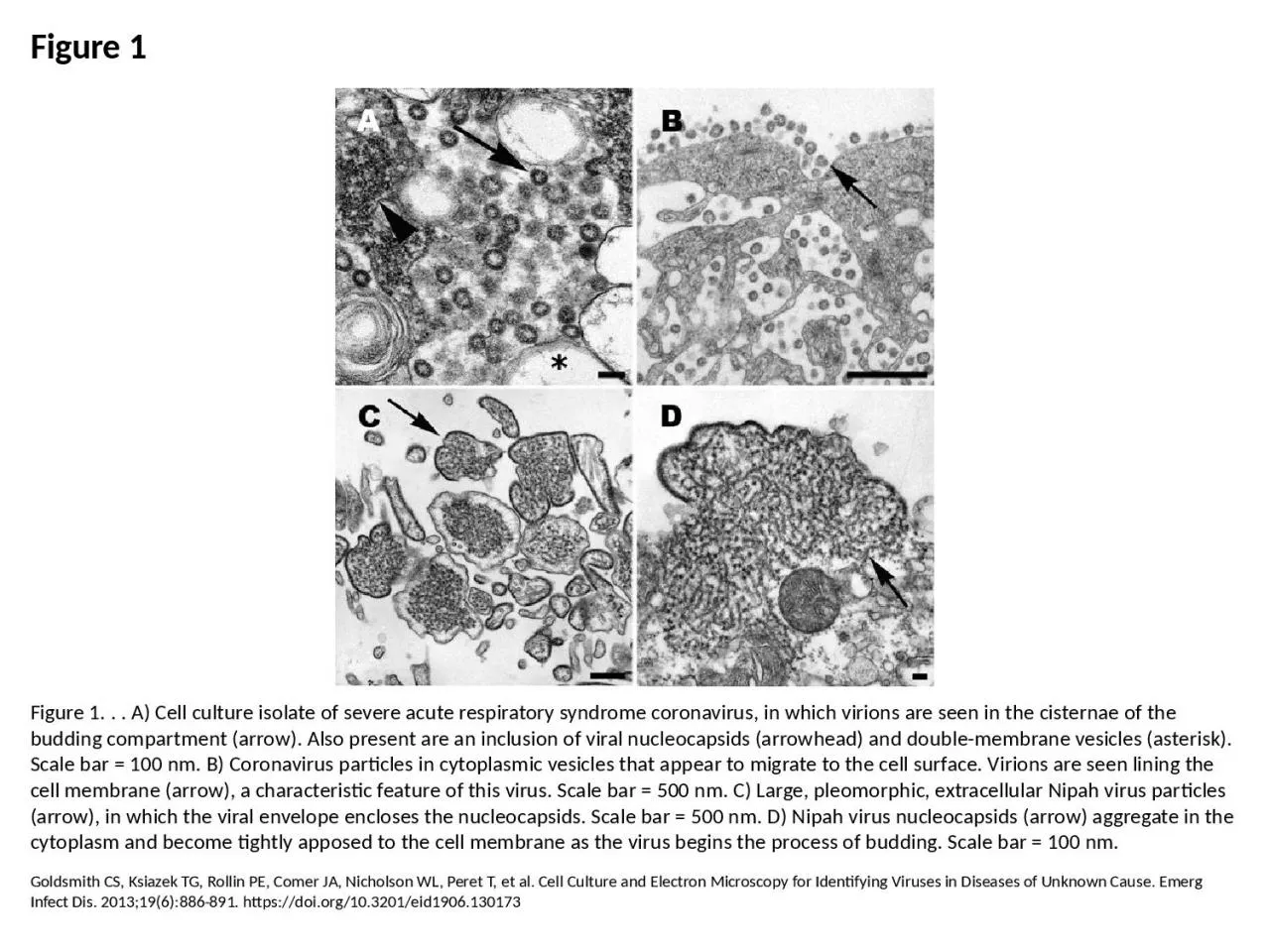 Figure 1 Figure 1. . . A) Cell culture isolate of severe acute respiratory syndrome coronavirus,
