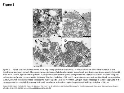 Figure 1 Figure 1. . . A) Cell culture isolate of severe acute respiratory syndrome coronavirus, in