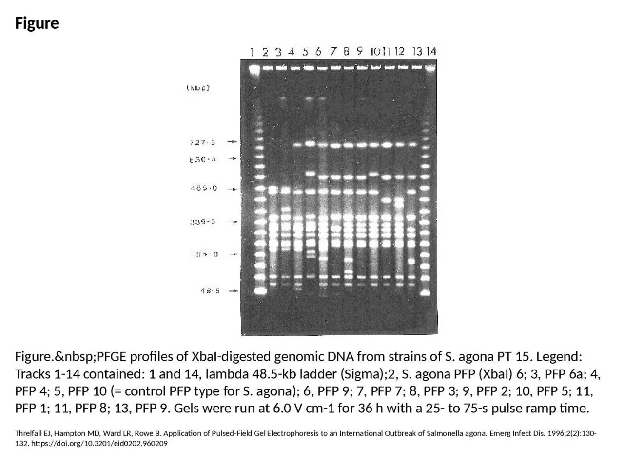 Figure Figure.&nbsp;PFGE profiles of XbaI-digested genomic DNA from strains of S.