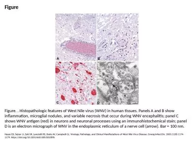 Figure Figure. . Histopathologic features of West Nile virus (WNV) in human tissues. Panels A and B